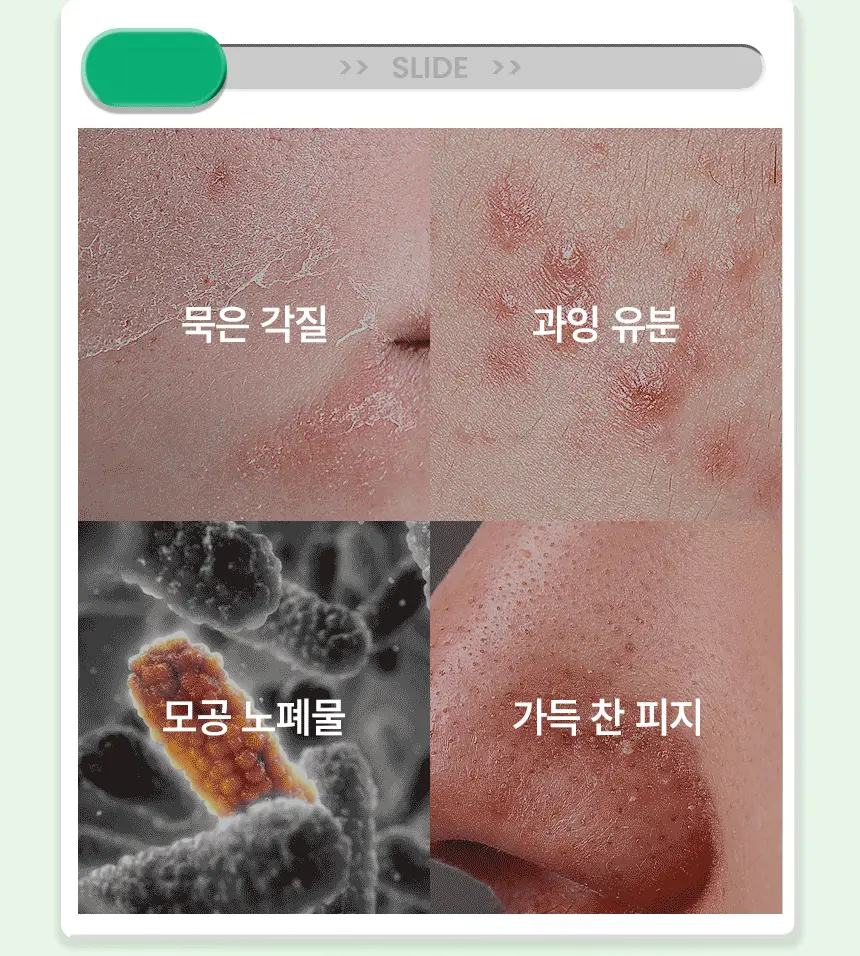 [화잘먹/1분퀵필링] 일소 노 트러블럼 필링 스왑 4g 1매 상세페이지 10